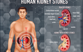 Best Kidney Stone specialist in Pune