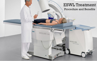 ESWL treatment for Kidney Stone in Pune