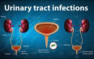 Urinary Incontinence treatment in Pune
