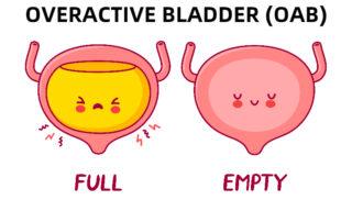 Best Treatment on Overactive Bladder OAB in Pune