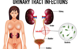 Urinary tract infection (UTI) treatemnt in Pune by Dr. Irfan Shaikh