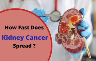 Kidney Cancer Specialist in Pune | Dr. Irfan Shaikh