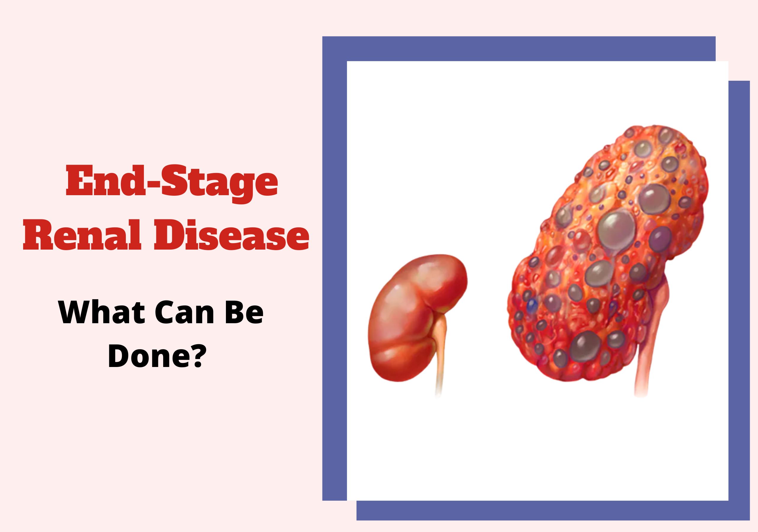 End Stage Renal Disease Kidney Disease What Can Be Done 