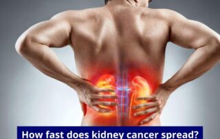 Kidney Cancer Treatment in Pune