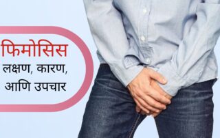 फिमोसिस (phimosis) ची लक्षण, कारण, आणि उपचार