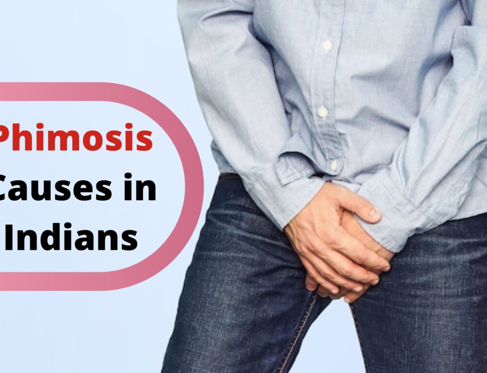 Phimosis Causes Symptoms And Treatment Urolife Clinic