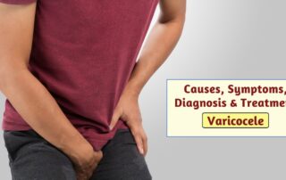 Varicocele - Causes, Symptoms, Diagnosis & Treatment
