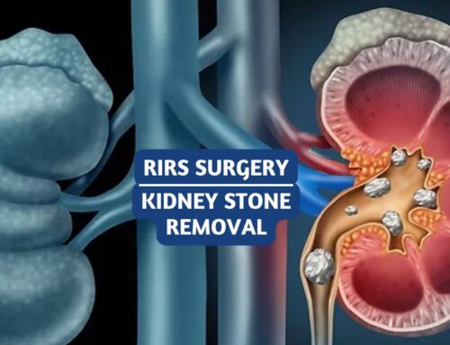 RIRS Surgery – Purpose, Procedure and Advantages