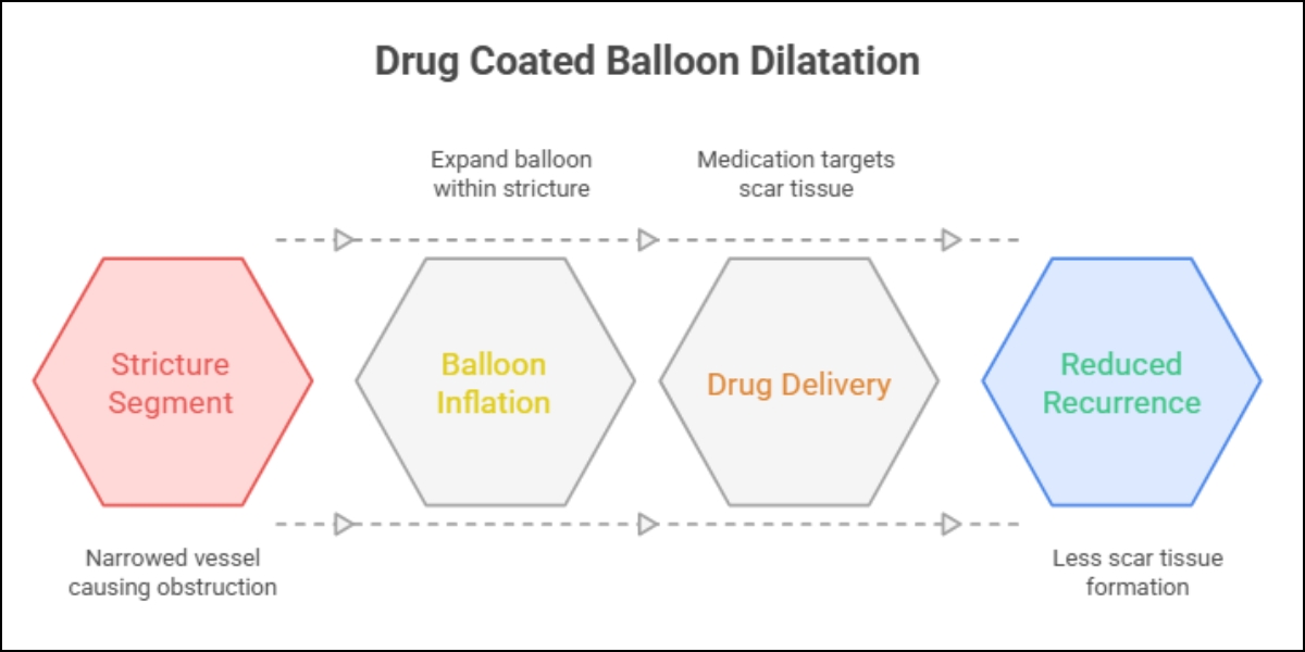 DCB Dilatation Work Flow