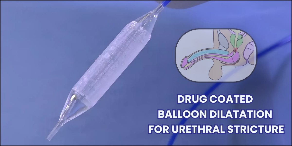 Drug Coated Ballon Dilation Treatment in pune