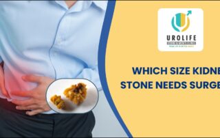 Which size kidney stone needs surgery?
