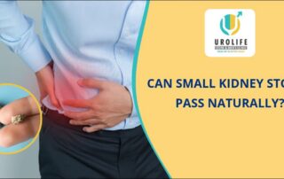 Can small kidney stone pass naturally?